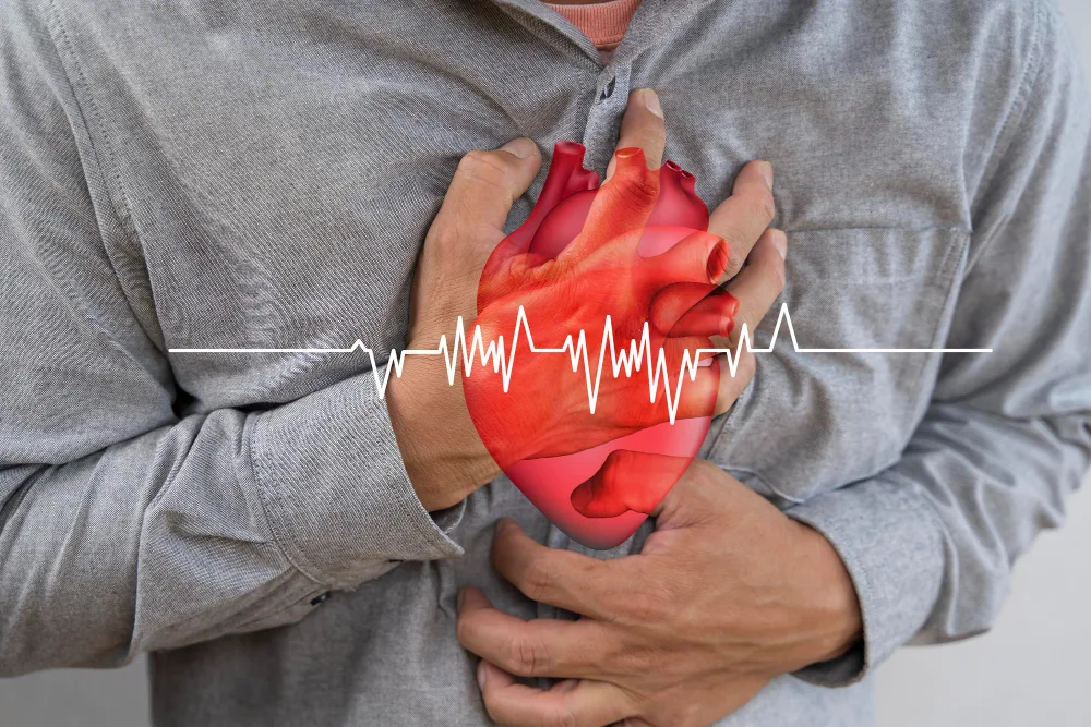 Atención de Cardiopatía Isquémica